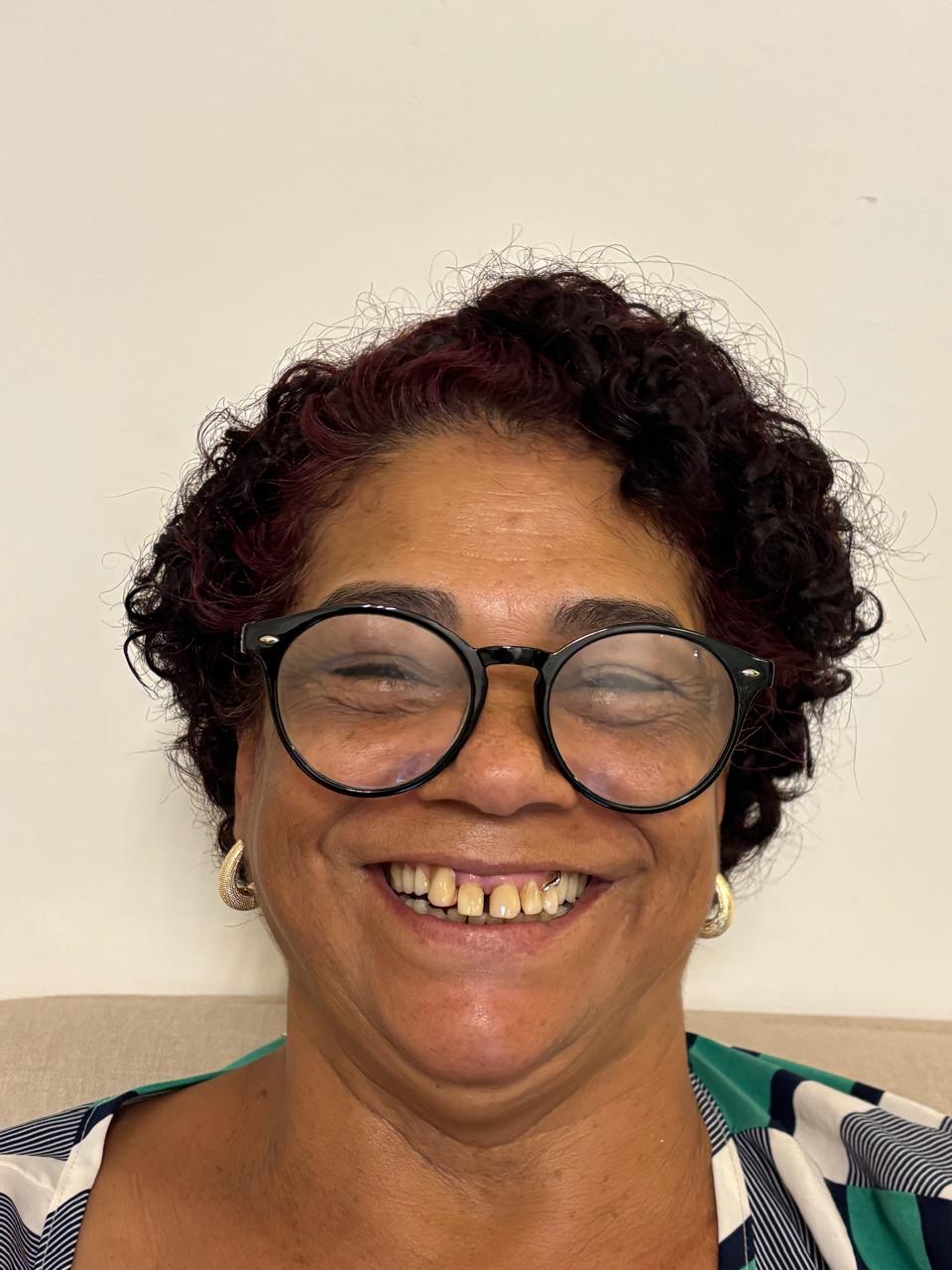 Facetas & Sorriso Completo — antes