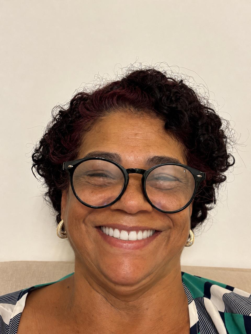 Facetas & Sorriso Completo — depois